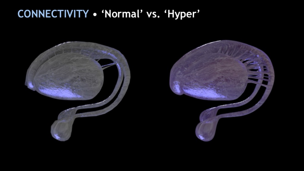 Normal Super Hyper What’s Expected of Us in a Block Universe: Intuition, Habit, & ‘Free ...